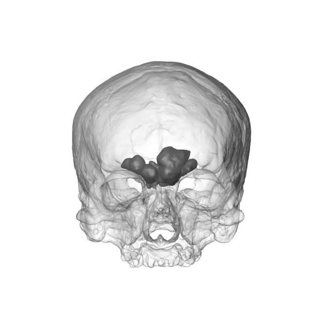 características del cráneo del homo heidelbergensis